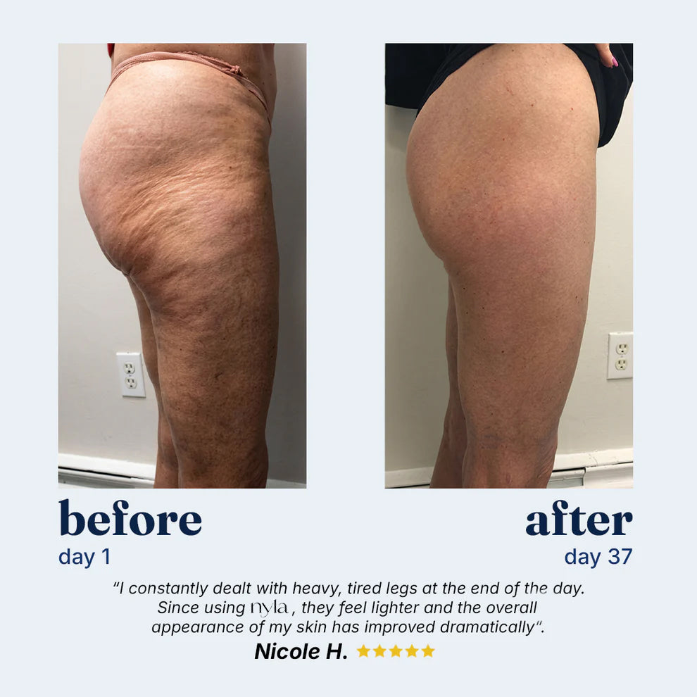 CelluSculpt™