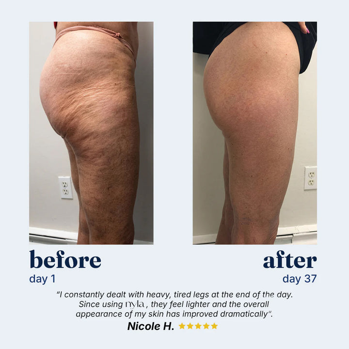 CelluSculpt™