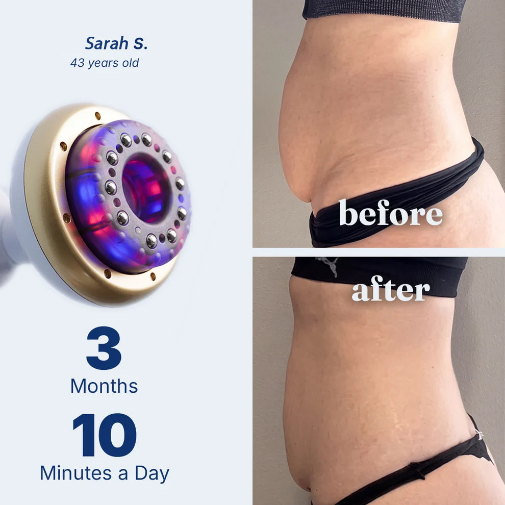 CelluSculpt™